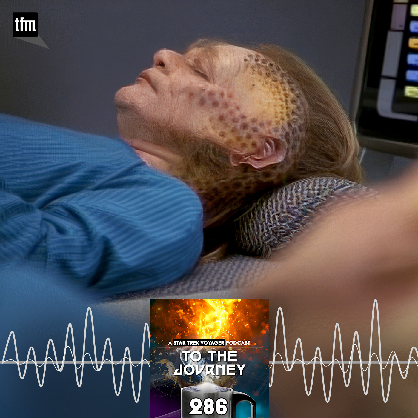 audio-thumbnail